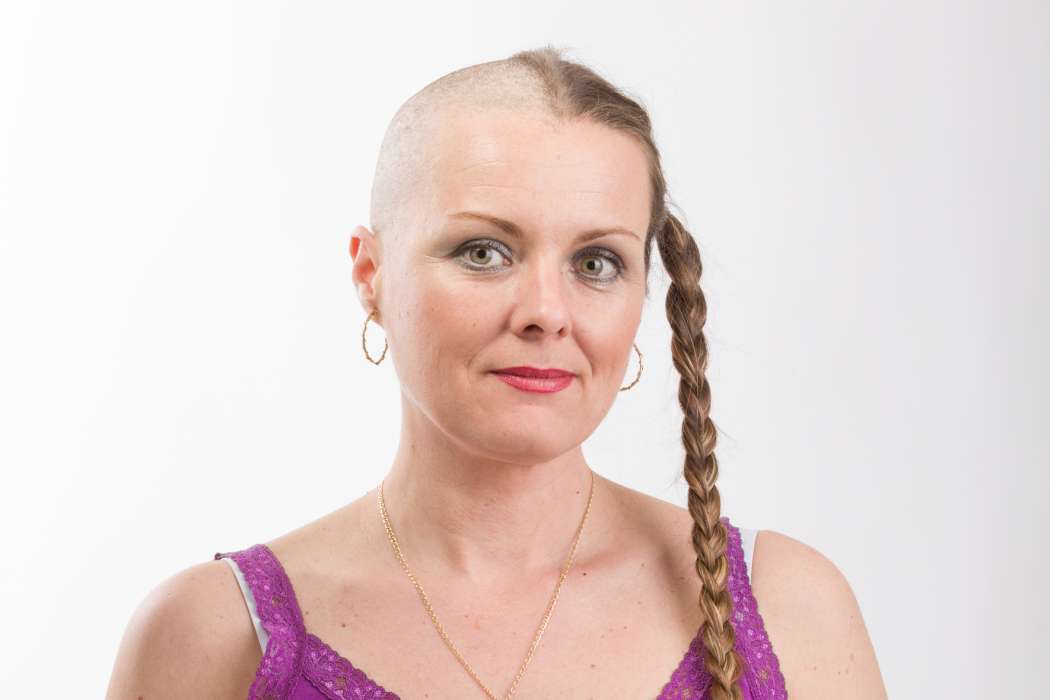 kemoterapija, izpadanje las, obrez