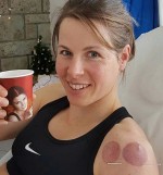 vesna fabjan terapija