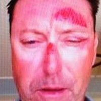 allenby-bashed.CACHE-924x924-20150118143729