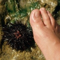 morski ježek