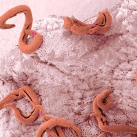 Schistosoma, Shistosomoza