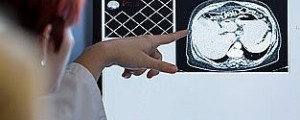 Odstranili so ji tumor v velikosti medicinske žoge