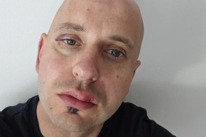 Župan Ribnice Samo Pogorelc je bil hudo telesno poškodovan