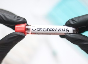 V BiH znova skoraj 250 novih okužb s koronavirusom