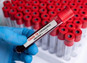 Omikron: to so pogoji, pod katerimi morate v karanteno