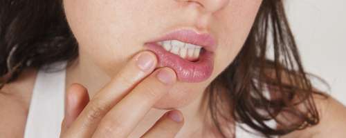 Bele pikice na ustnicah – so nalezljive?