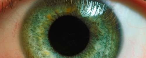 Spremembe v očeh opozarjajo na različne zdravstvene nevšečnosti