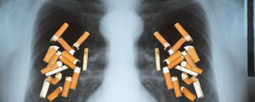 Kaj se v telesu zgodi, ko prenehamo kaditi?