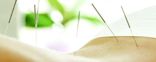 Je zdravljene z akupunkturo učinkovito?