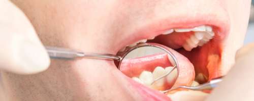 Vpliv ustnega zdravja na pojav bolezni