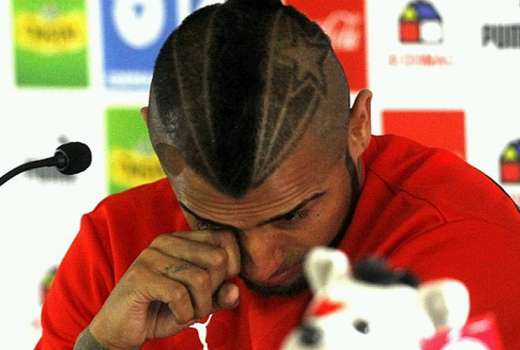 arturo vidal solze