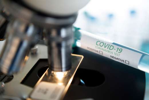 koronavirus, covid-19, testiranje, test