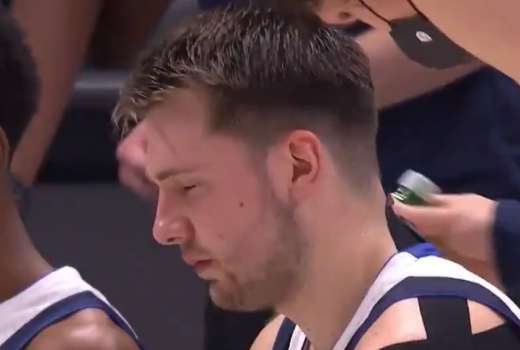 doncic klop