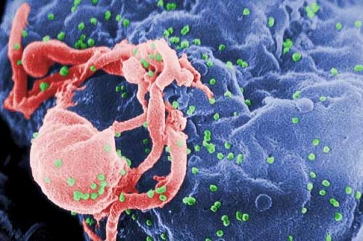Italijan z virusom hiv okužil 30 žensk; bo umrl za rešetkami?