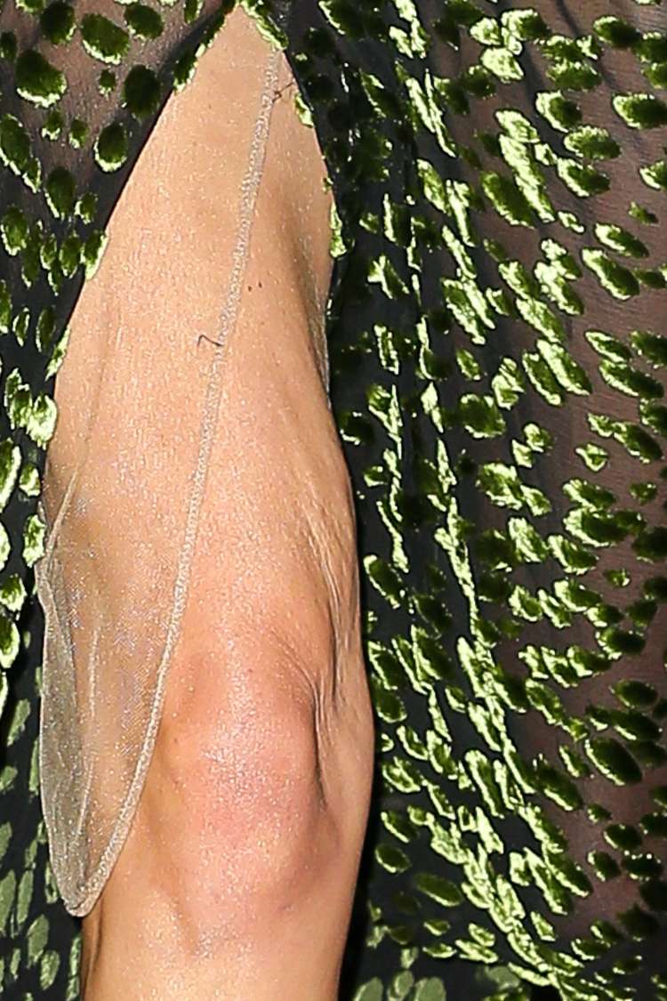 Kate Bosworth