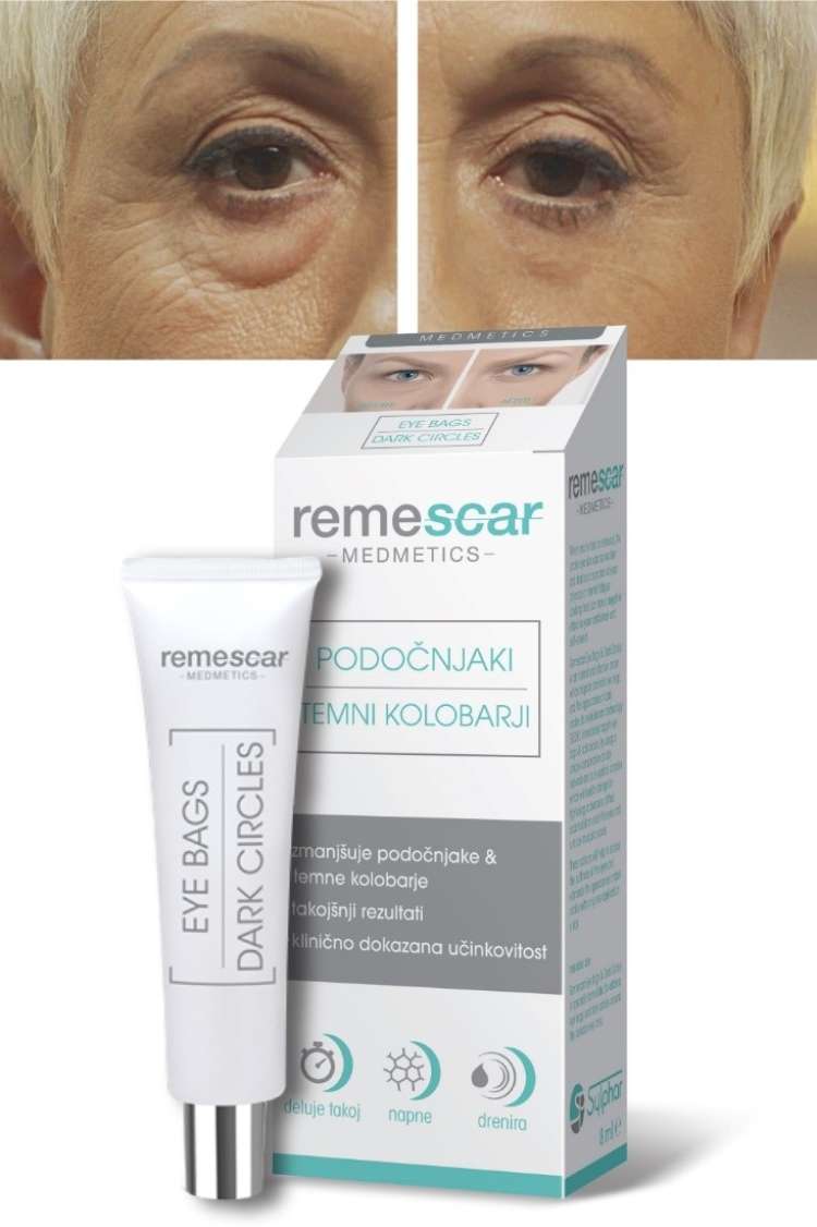 kolobar 2