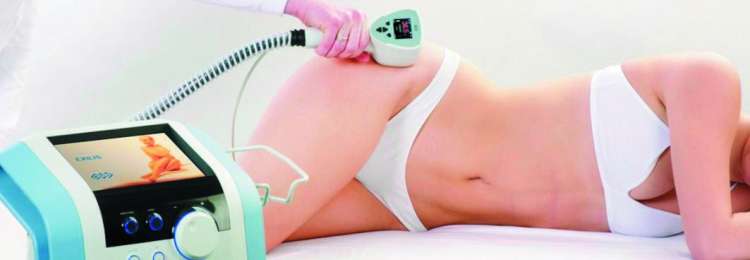 celulit exilis telo.jpg