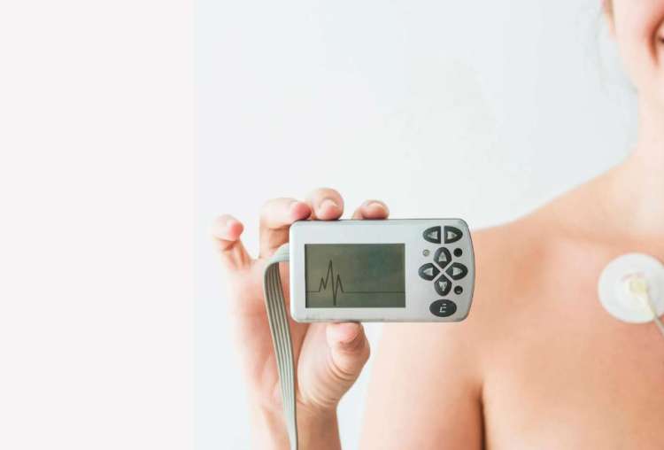 Holter monitoring