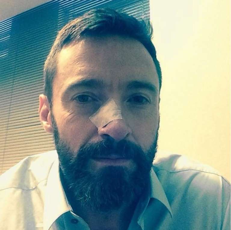 Hugh Jackman.jpg
