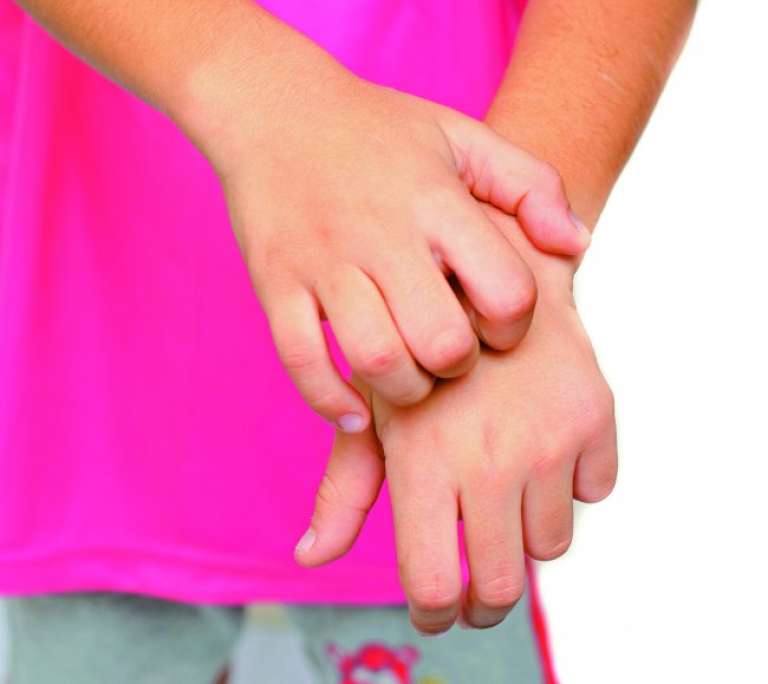 Impetiga ne prenašajo komarji