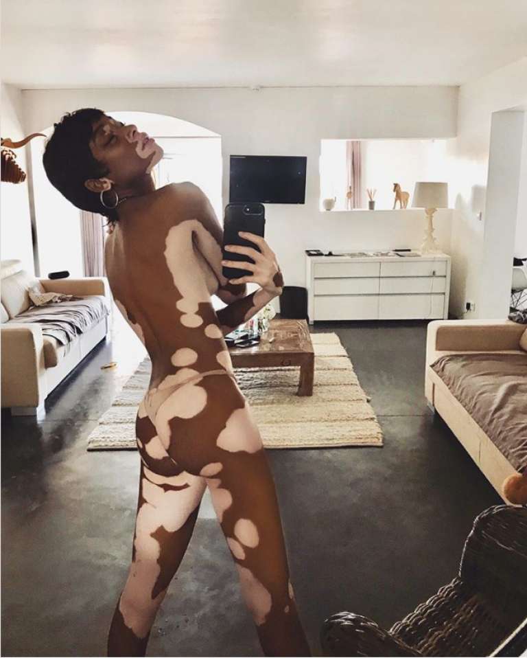 Winnie Harlow.png