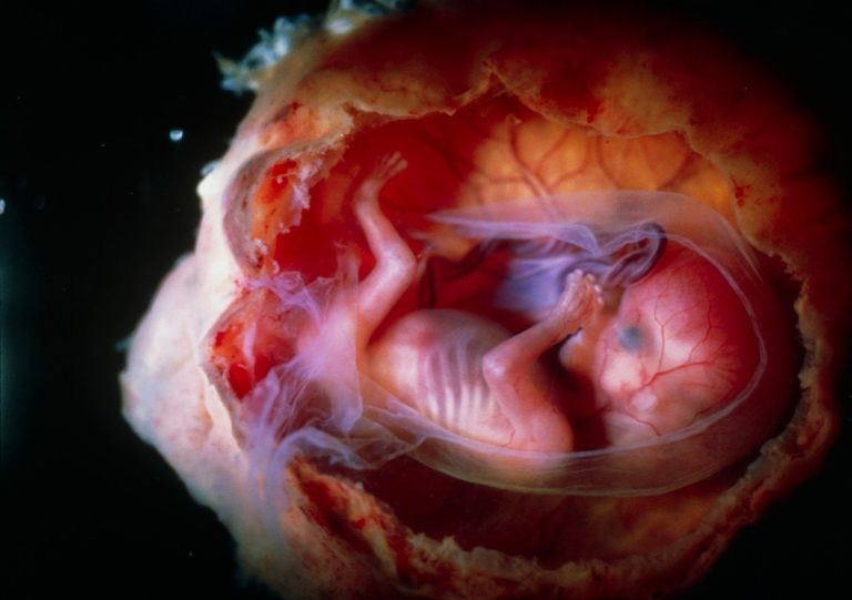fetus.jpg