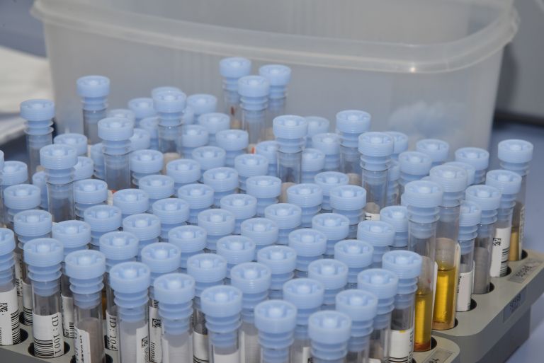 murska-sobota, oddelek-za-laboratorijsko-diagnostiko, splošna-bolnica-murska-sobota