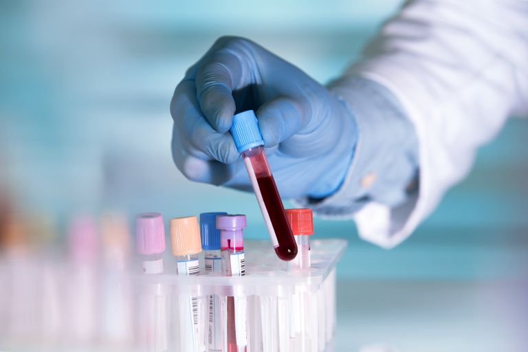 pfas, pfas-resitve, vecne-kemikalije, kemikalije-in-zdravje, okolje-in-hrano-koper, kemicno-onesnazenje, oxyle, gradient-corp