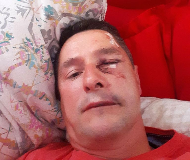 andrej-gorisek, rom, napad