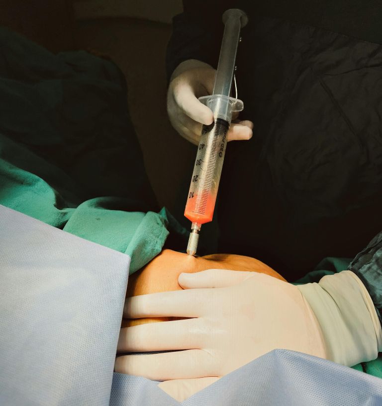 liposukcija