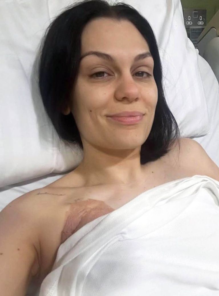 jessie-j