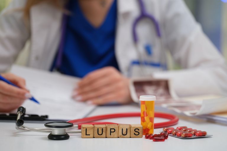 lupus, bolezen