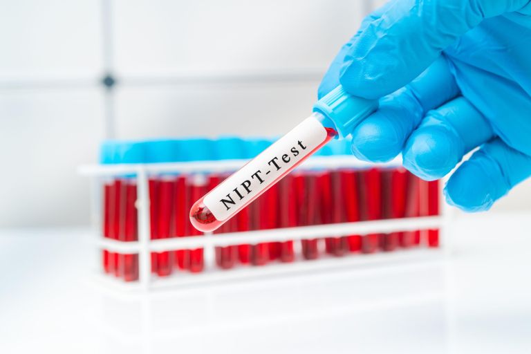 NIPT test, odvzem krvi