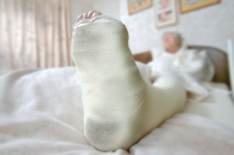 zlom, gips