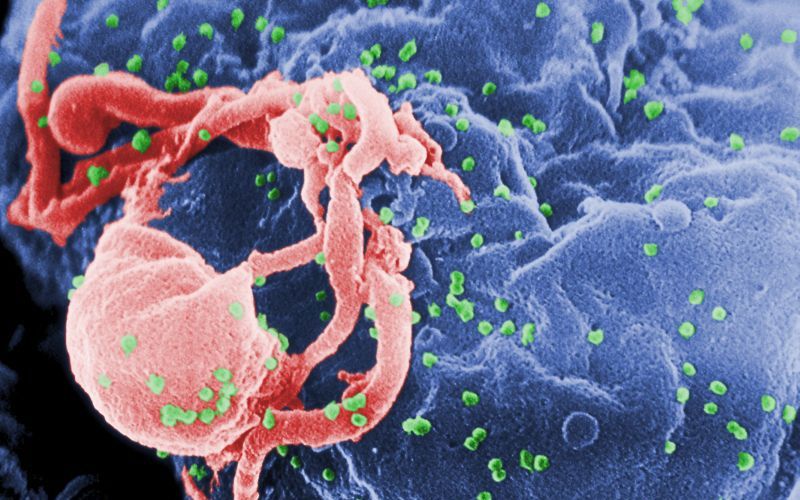 hiv.jpg