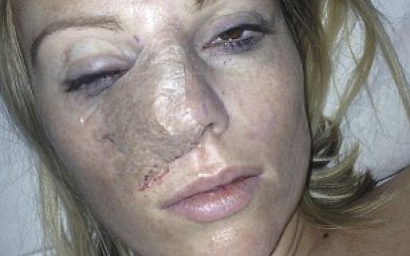 Michelle Dewberry