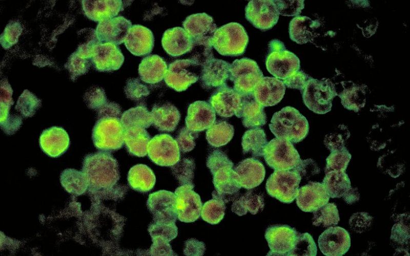 ameba Naegleria fowleri.jpg