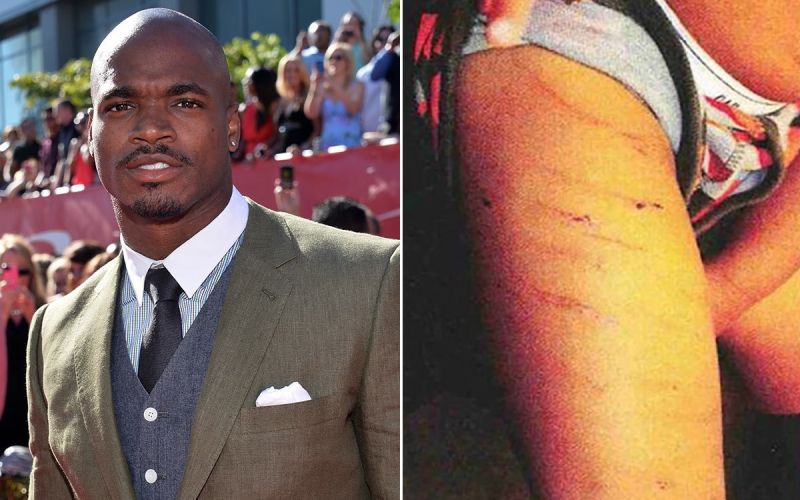 adrian-peterson pretepel sina.jpg