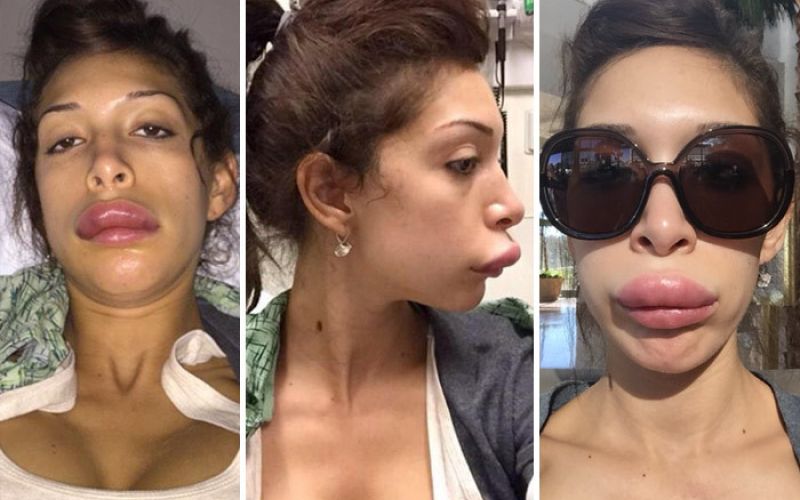 0106-farrah-abraham-lips-twitter-9.jpg