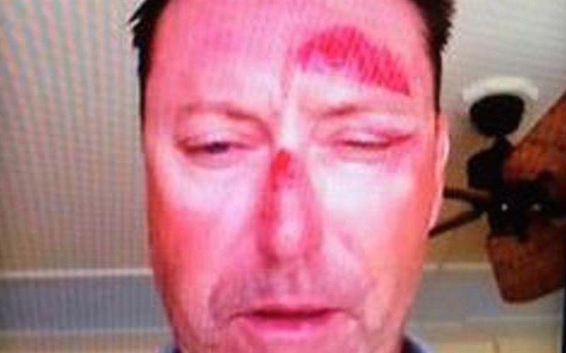 allenby-bashed.CACHE-924x924-20150118143729.jpg