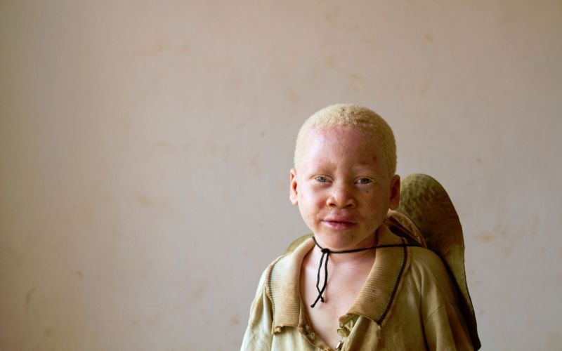 Albino 2.jpg