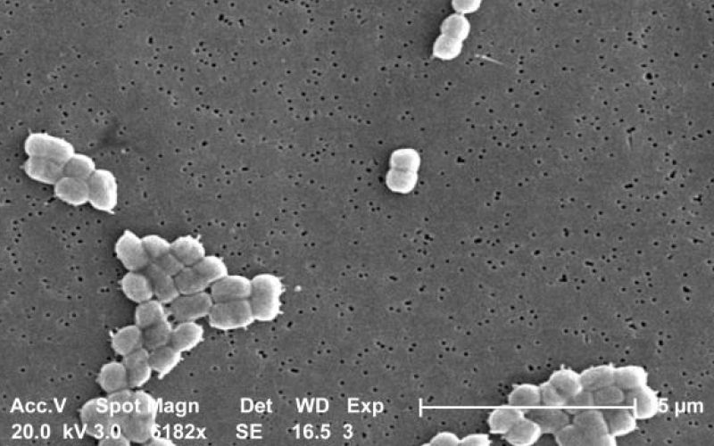 Acinetobacter baumannii bakterija.jpg