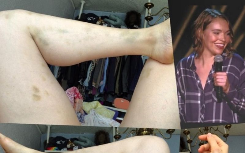 Beth Stelling, modrice