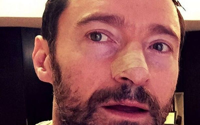 Hugh-Jackman
