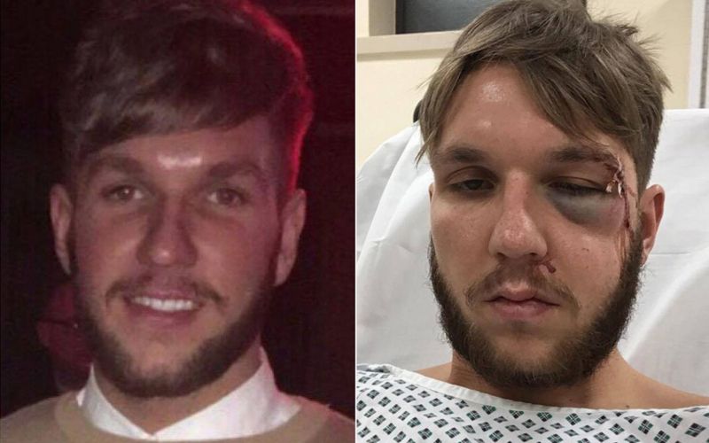 Jack-Wheats-injuries-after-playing-for-Goole-AFC-main.jpg
