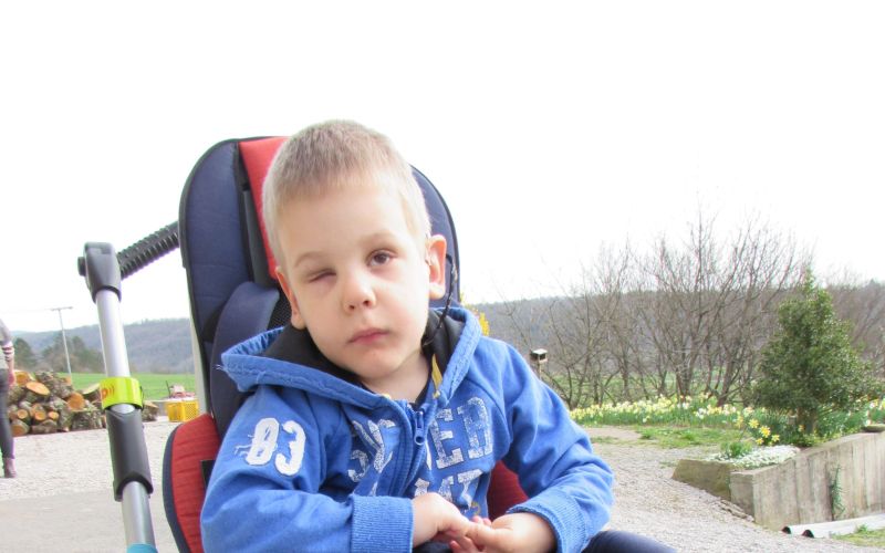 vid enojajčni dvojček bolezen deček.jpg