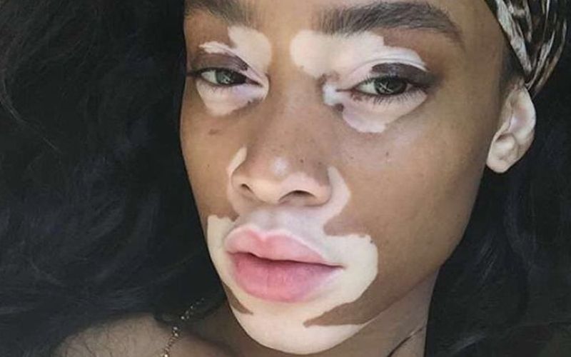 winnie harlow.jpg