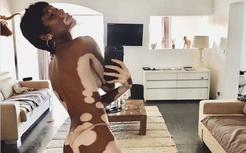Winnie Harlow.png