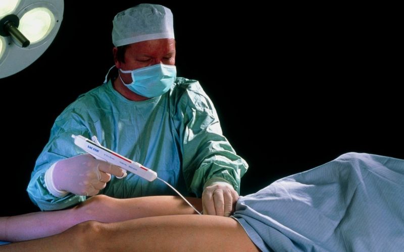 srcno-zilne opornice, stents, operacija
