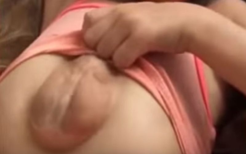 srce, deklica, Cantrellova pentalogija,